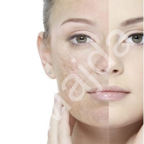 ZDRAVÁ POKOŽKA BEZ AKNÉ (2)